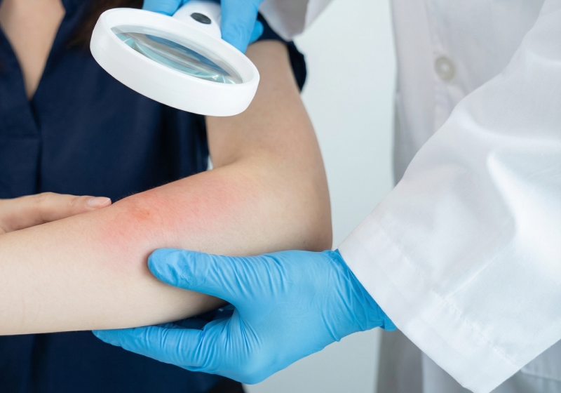 Прием дерматолога