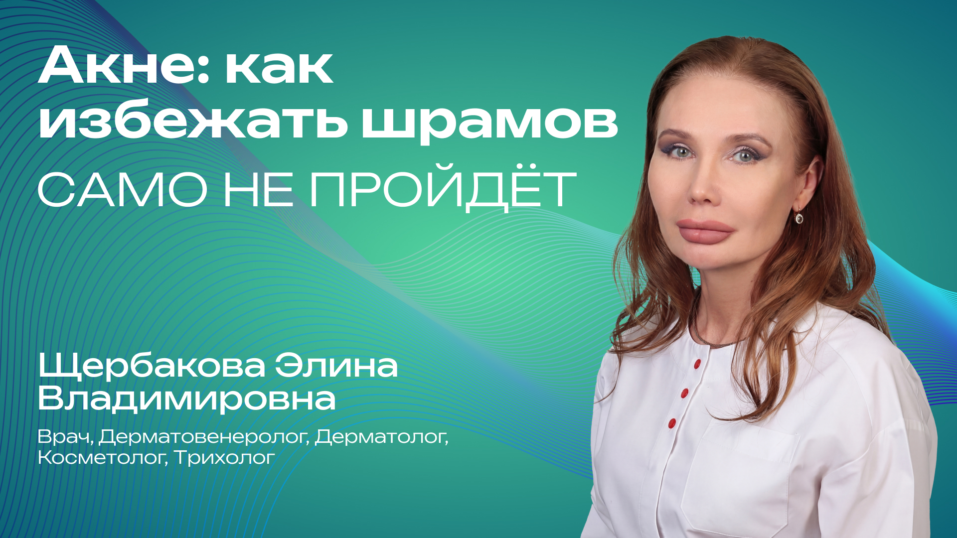Превью для видео