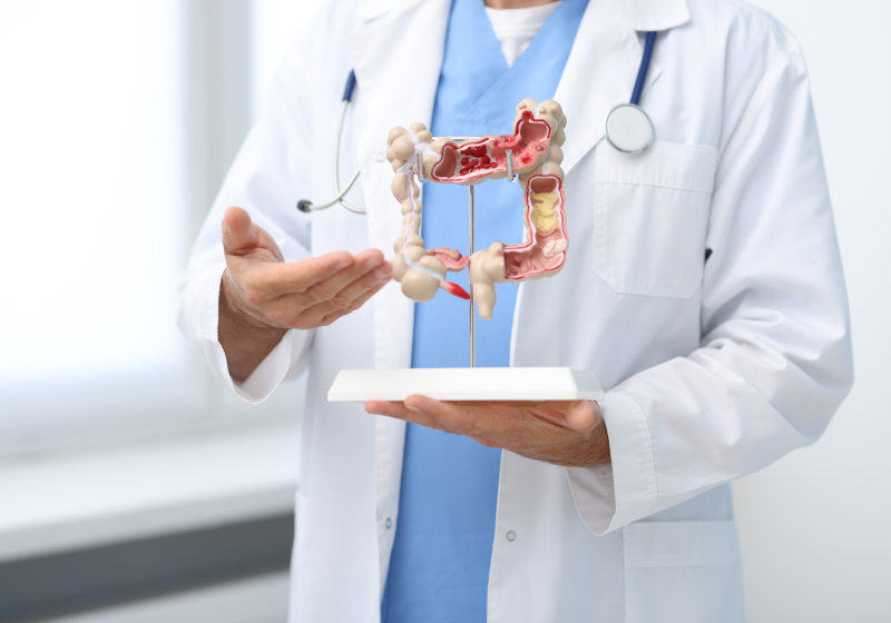 Колоноскопия