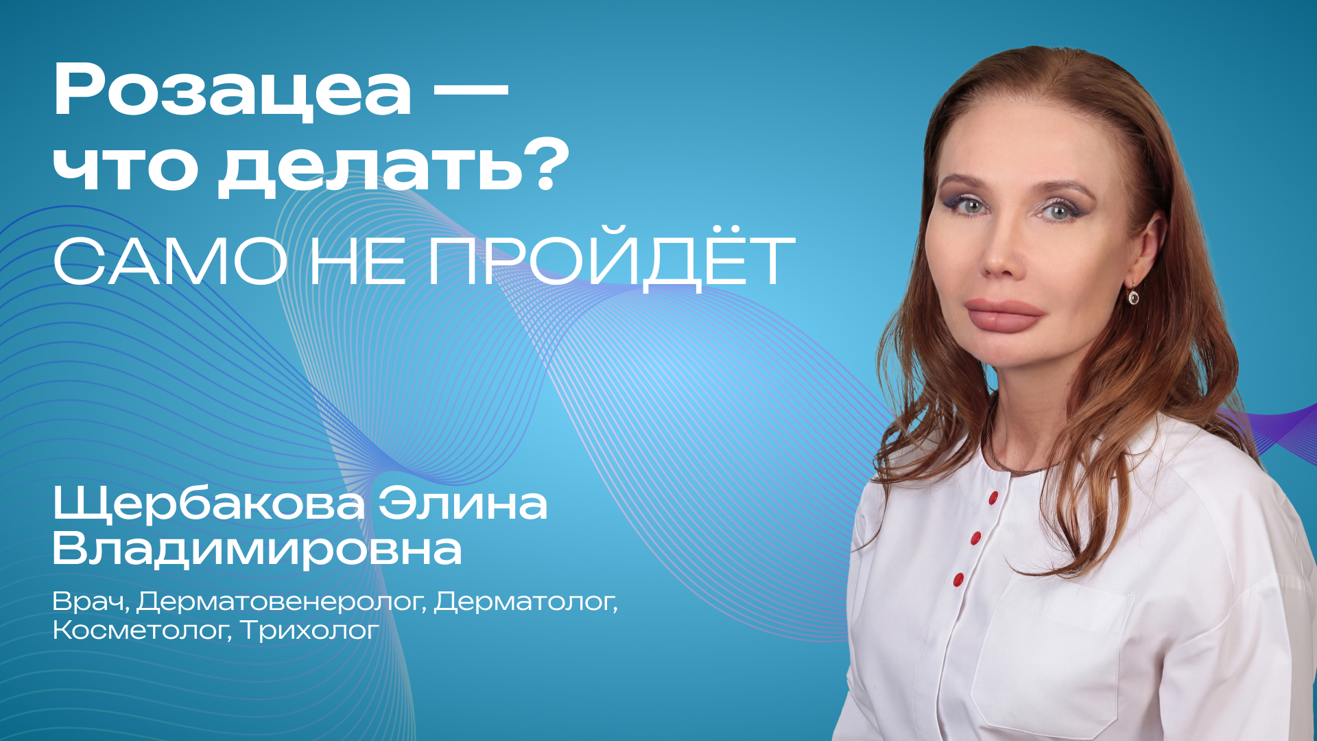 Превью для видео