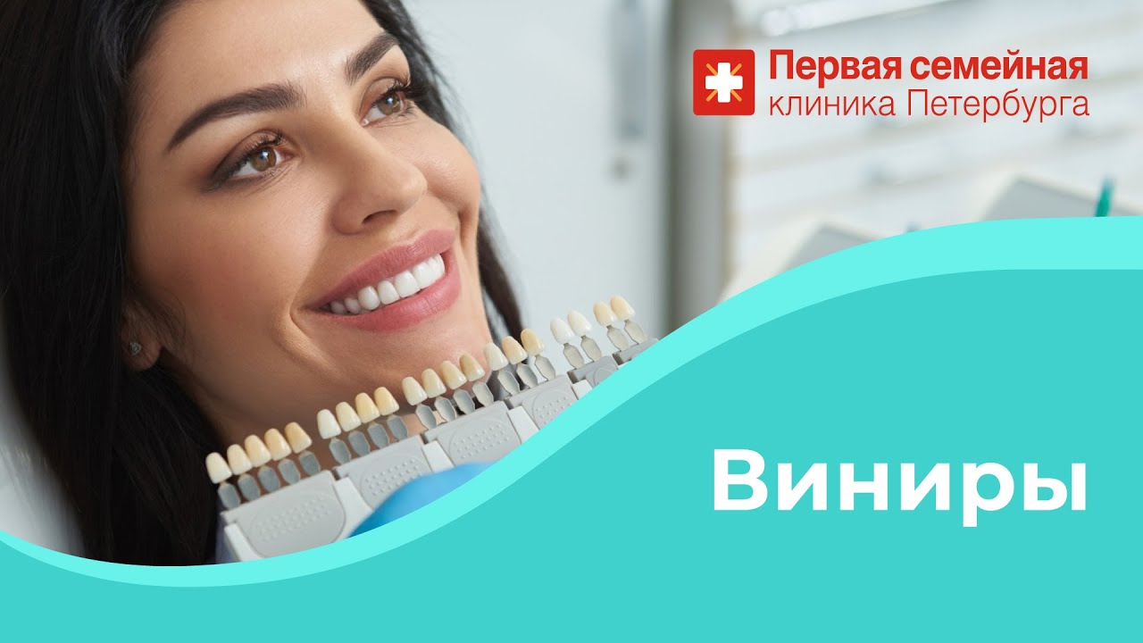 Виниры