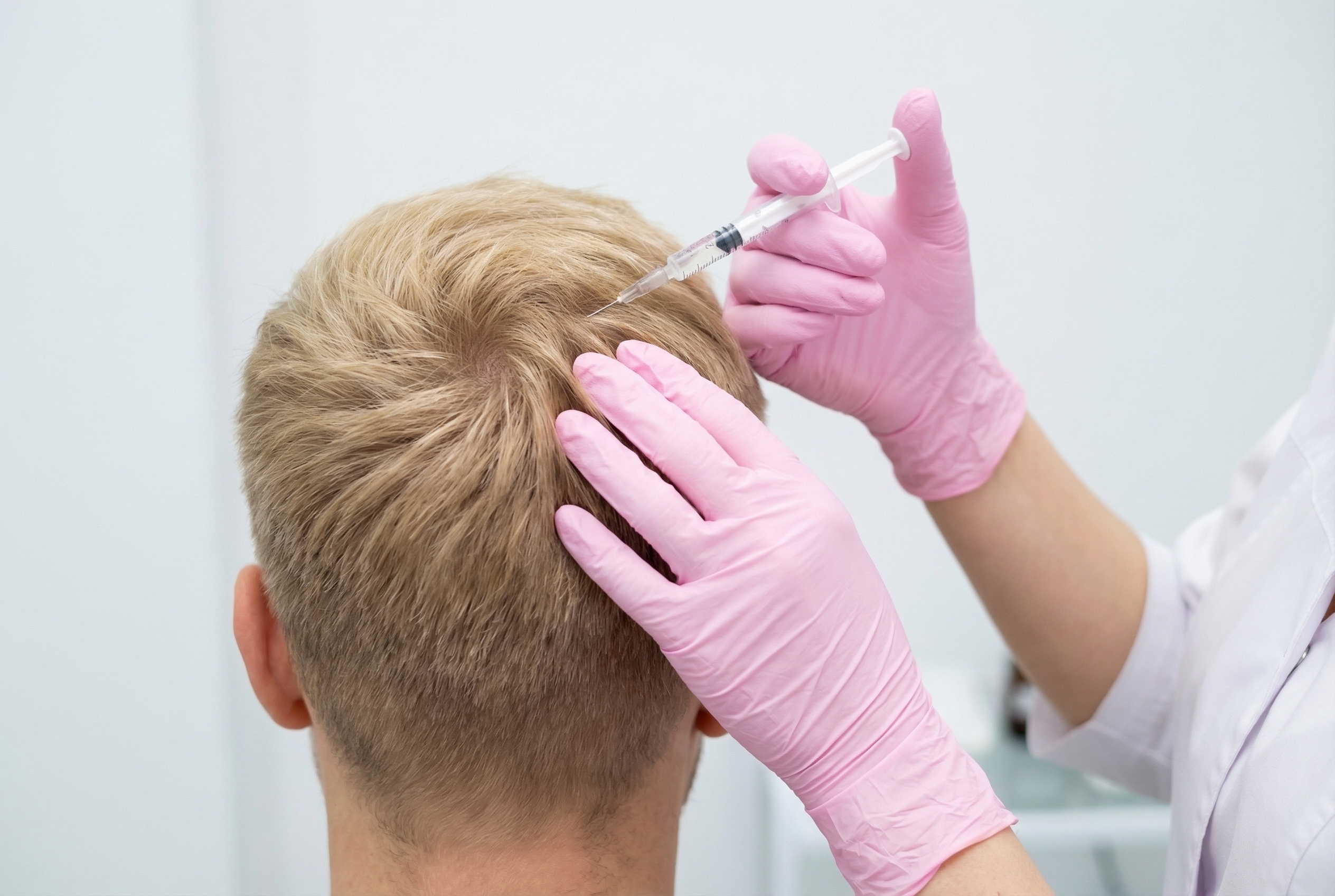 Мезотерапия волос