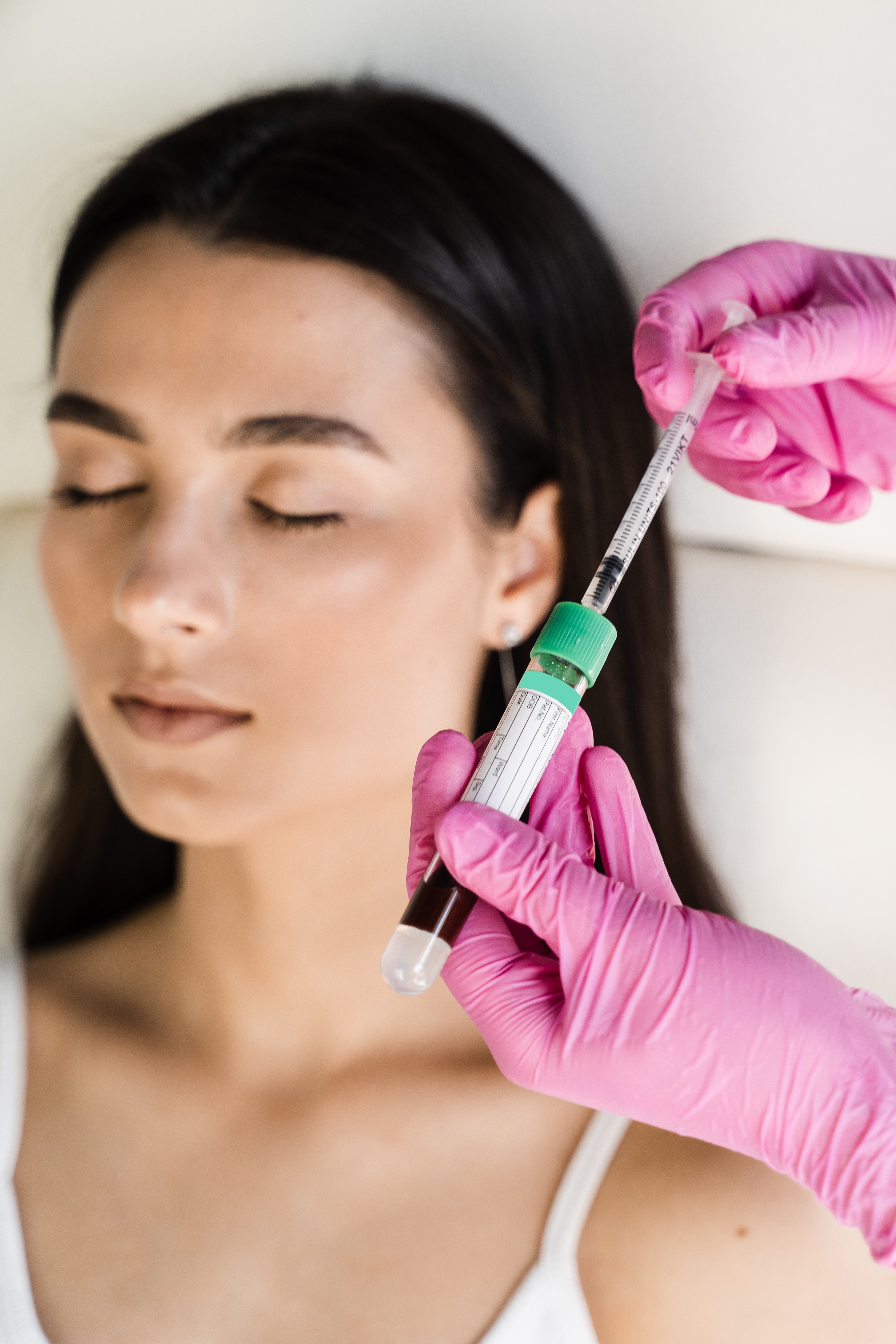 Плазмолифтинг